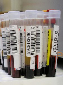 Determination of chronotype via new blood test